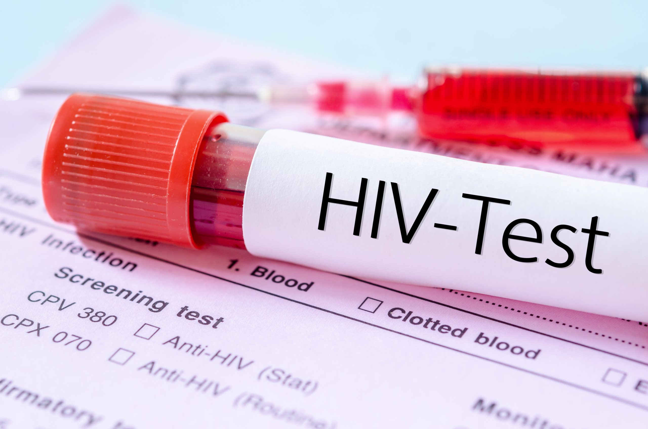 Ghana recorded 17,774 new HIV infections in 2023 | Ghana News Agency